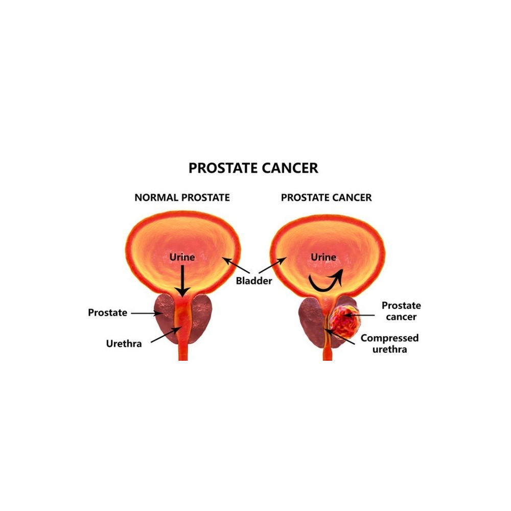 Prostate Health - Sanatate Prostata 60 Capsule, Biovea Prostate Health de la Biovea sustine o prostata sanatoasa si poate fi ben