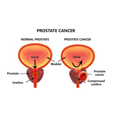 Prostate Health - Sanatate Prostata 60 Capsule, Biovea Prostate Health de la Biovea sustine o prostata sanatoasa si poate fi ben