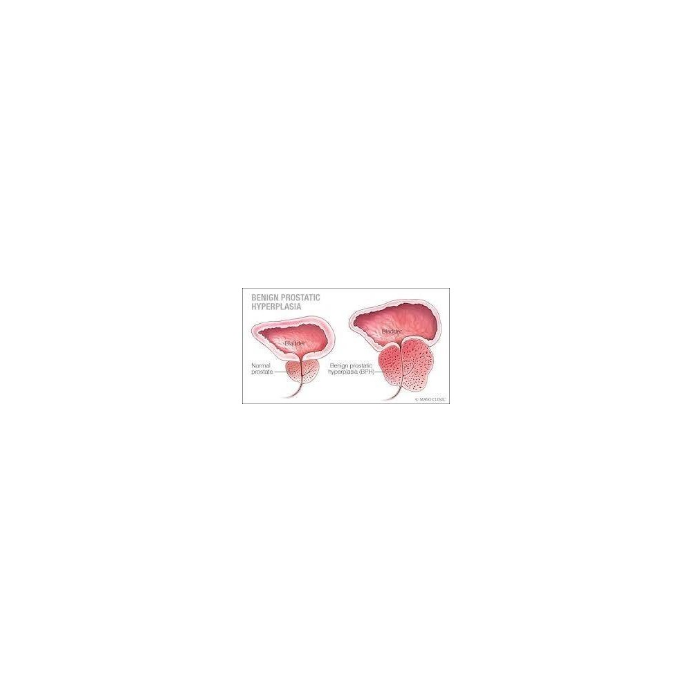 Prostate Bio 120 Capsule, Tratament pentru prostata, Belle&Bio Prostate Bio beneficii: ameliorator naturist prostata, sustine fu
