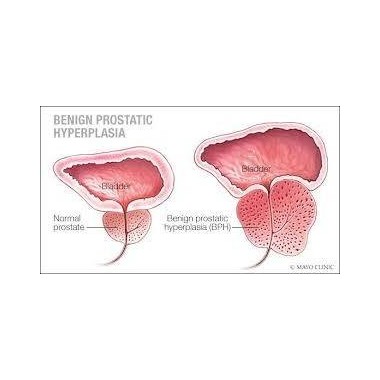 Prostate Bio 120 Capsule, Tratament pentru prostata, Belle&Bio Prostate Bio beneficii: ameliorator naturist prostata, sustine fu