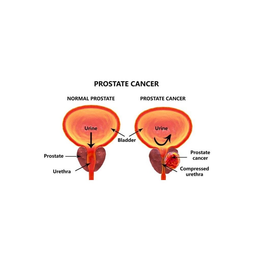 Prostate Bio 120 Capsule, Tratament pentru prostata, Belle&Bio Prostate Bio beneficii: ameliorator naturist prostata, sustine fu