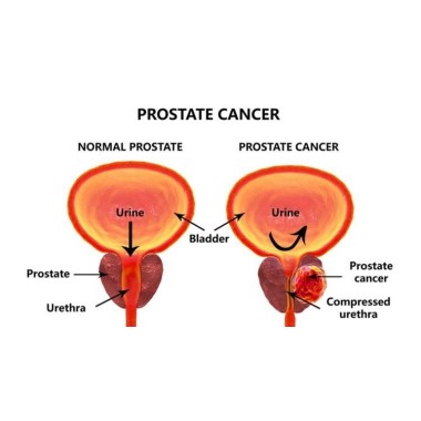 Prostate Bio 120 Capsule, Tratament pentru prostata, Belle&Bio Prostate Bio beneficii: ameliorator naturist prostata, sustine fu