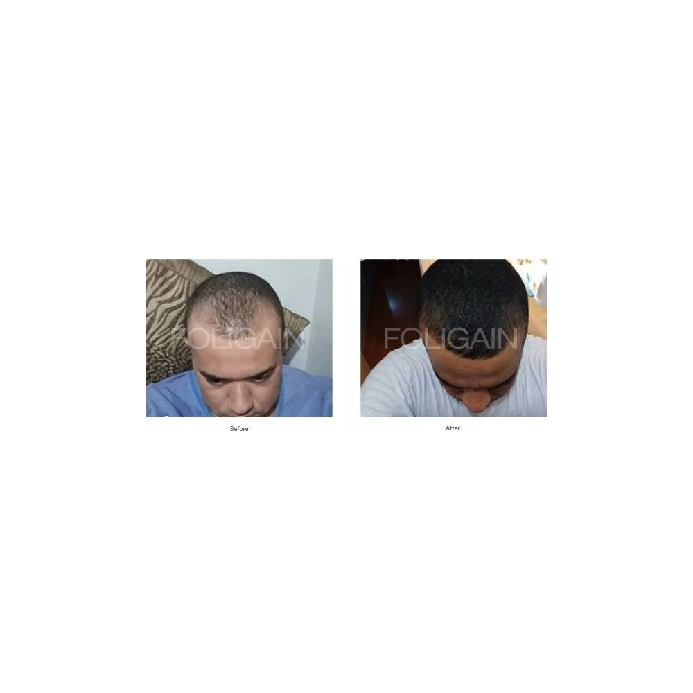 FOLIGAIN Sampon pentru regenerarea parului pentru barbati 2% Trioxidil® (8oz) 236ml Sampon pentru regenerarea parului la barbati