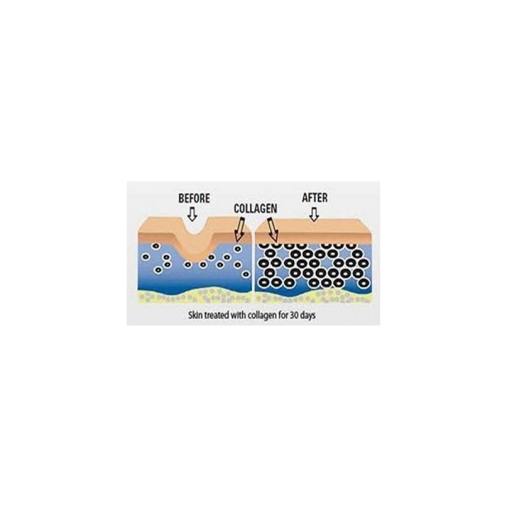 Colagen Hidrolizat Tip 1 & 3 120 Capsule, Biovea Colagen Hidrolizat beneficii: reduce liniile fine si ridurile, imbunătățește hi