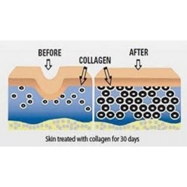 Colagen Hidrolizat Tip 1 & 3 120 Capsule, Biovea Colagen Hidrolizat beneficii: reduce liniile fine si ridurile, imbunătățește hi