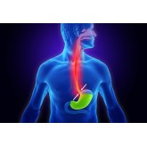Reflux acid gastric